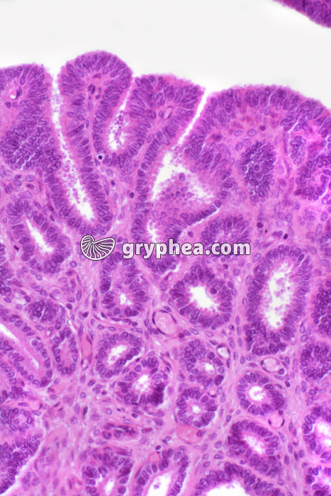 Utérus Lapine pré-oestrus x100 - gryphea.com